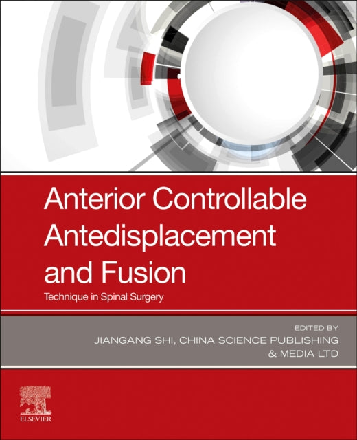 Book cover of: Anterior Controllable Antedisplacement and Fusion. By: Jiangang Shi