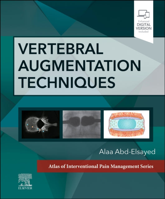 Book cover of: Vertebral Augmentation Techniques. By: Alaa Abd-Elsayed