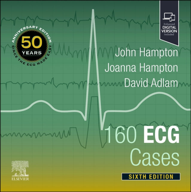 Book cover of: 160 ECG Cases. By: John Hampton