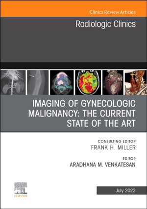 Imaging of Gynecologic Malignancy