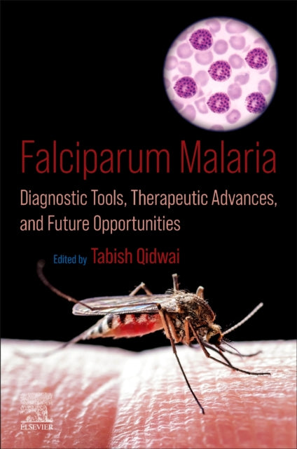Book cover of: Falciparum Malaria. By: Tabish Qidwai