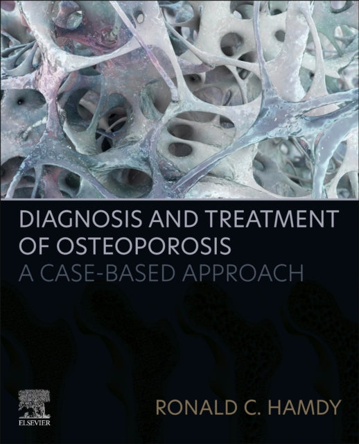Book cover of: Diagnosis and Treatment of Osteoporosis. By: Ronald C. Hamdy