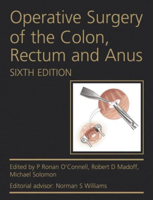 Book cover of: Operative Surgery of the Colon, Rectum and Anus. By: P. Ronan O'Connell