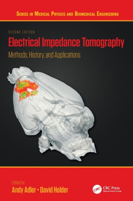 Book cover of: Electrical Impedance Tomography. By: David Holder