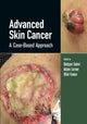 Book cover of: Advanced Skin Cancer. By: Debjani Sahni