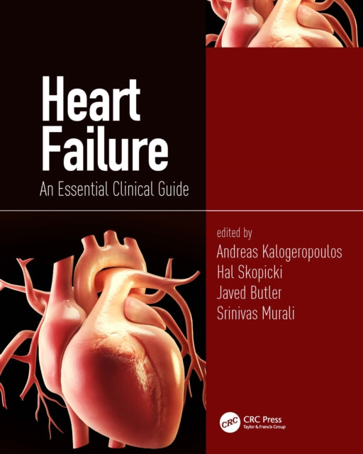 Book cover of: Heart Failure. By: Andreas Kalogeropoulos