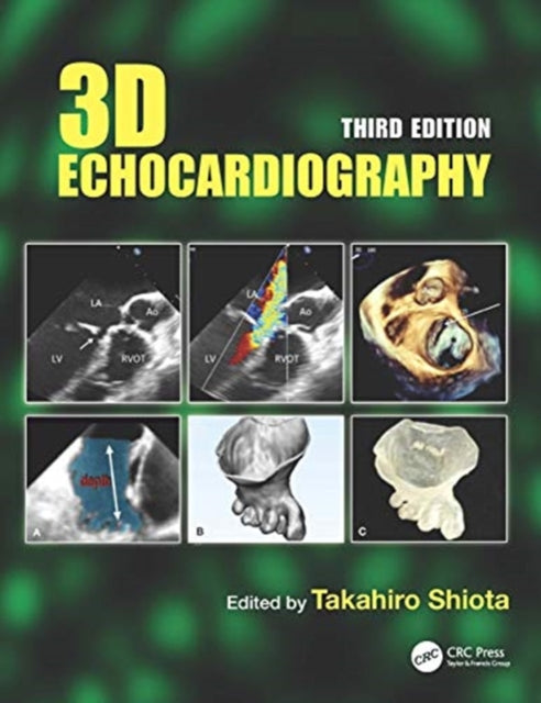 Book cover of: 3D Echocardiography. By: Takahiro Shiota