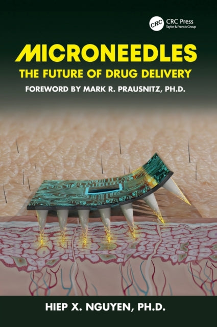 Book cover of: Microneedles. By: Hiep Xuan Nguyen