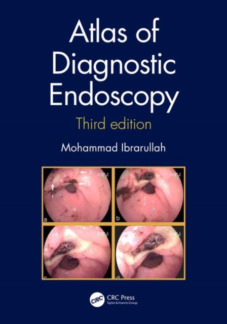 Book cover of: Atlas of Diagnostic Endoscopy, 3E. By: Mohammad Ibrarullah