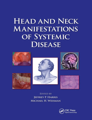 Head and Neck Manifestations of Systemic Disease