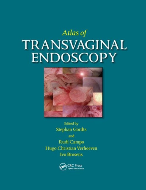 Book cover of: Atlas of Transvaginal Endoscopy. By: Stephan Gordts