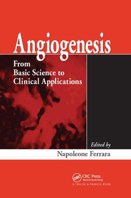 Book cover of: Angiogenesis
