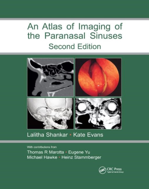Book cover of: Atlas of Imaging of the Paranasal Sinuses, Second Edition. By: Lalitha Shankar