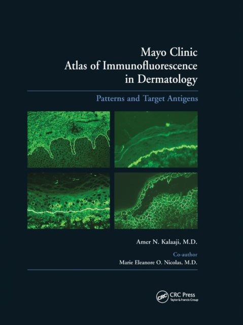Book cover of: Mayo Clinic Atlas of Immunofluorescence in Dermatology. By: Amer N. Kalaaji