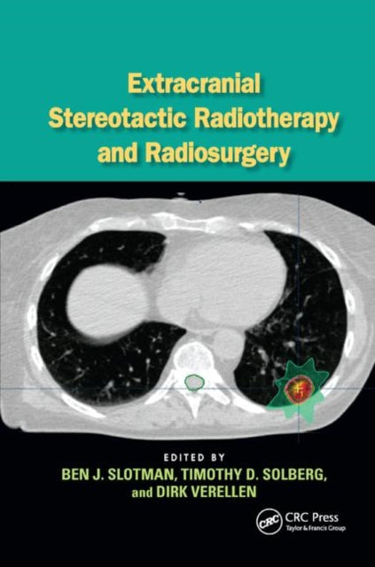 Book cover of: Extracranial Stereotactic Radiotherapy and Radiosurgery. By: Ben J. Slotman