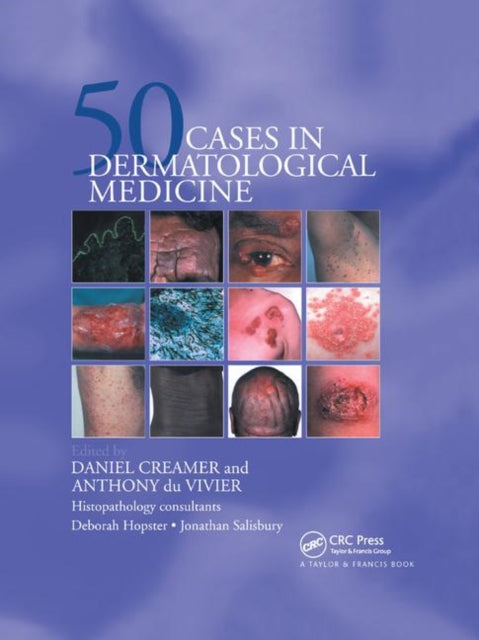 Book cover of: Fifty Dermatological Cases. By: Daniel Creamer
