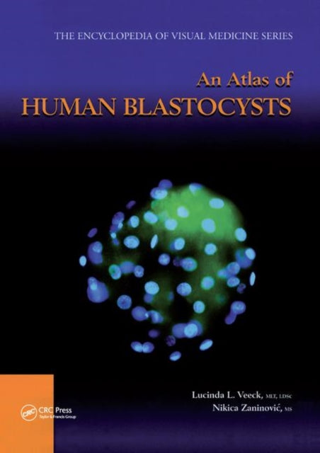 Book cover of: Atlas of Human Blastocysts. By: Lucinda L. Veeck