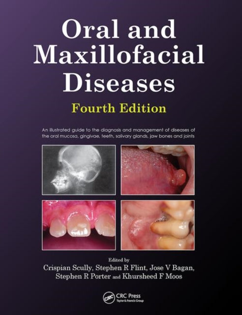 Book cover of: Oral and Maxillofacial Diseases, Fourth Edition. By: Crispian Scully