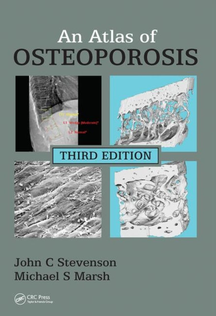 Book cover of: Atlas of Osteoporosis. By: John C. Stevenson