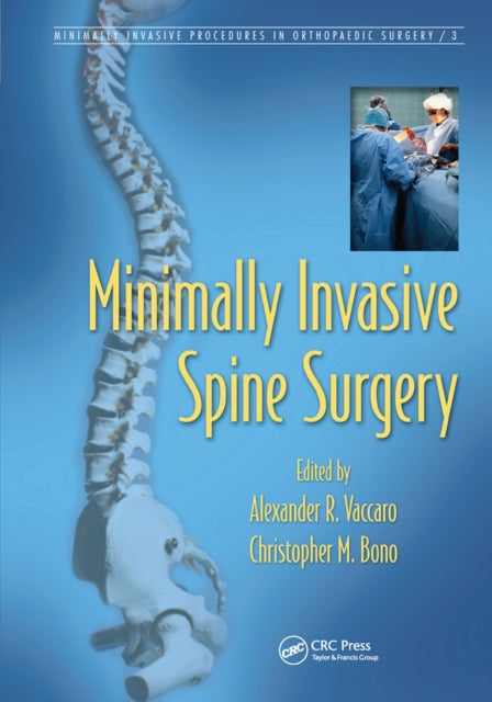 Book cover of: Minimally Invasive Spine Surgery. By: Alexander R. Vaccaro