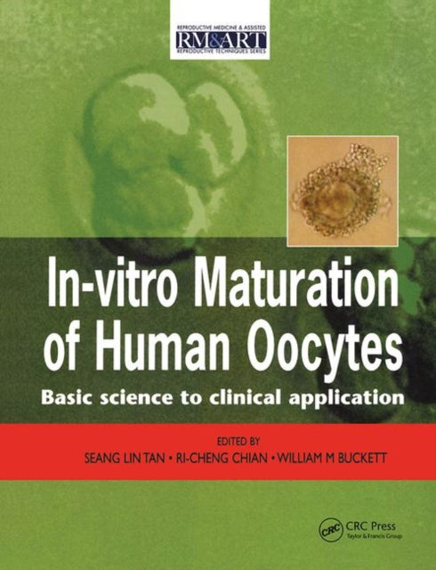 Book cover of: In Vitro Maturation of Human Oocytes