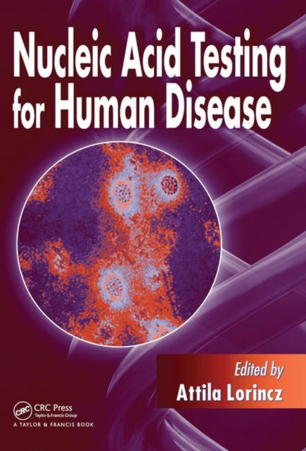 Book cover of: Nucleic Acid Testing for Human Disease
