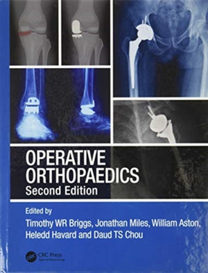 Operative Orthopaedics