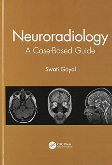 Book cover of: Neuroradiology. By: Swati Goyal