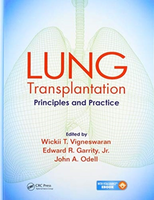 Book cover of: Lung Transplantation. By: Wickii T. Vigneswaran