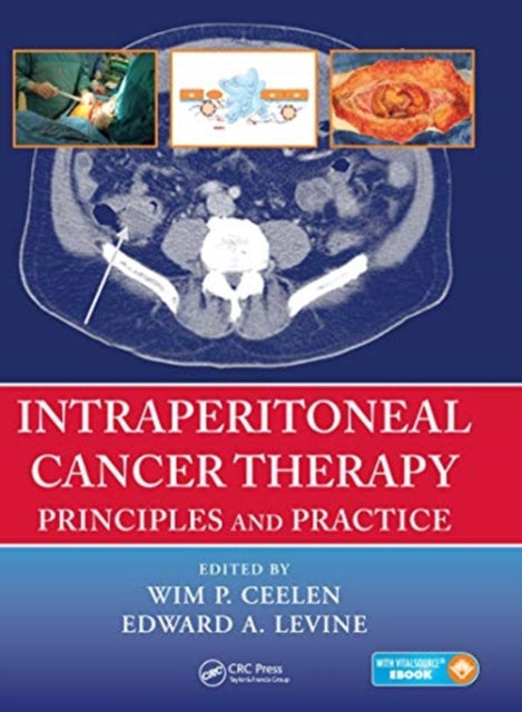Book cover of: Intraperitoneal Cancer Therapy. By: W. P. Ceelen