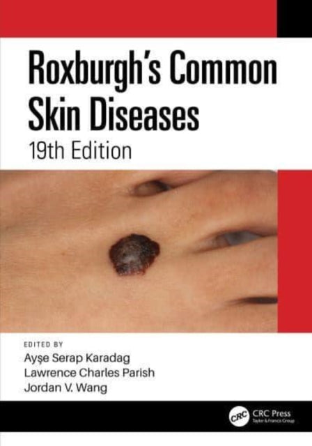 Book cover of: Roxburgh's Common Skin Diseases. By: Ayse Serap Karadag