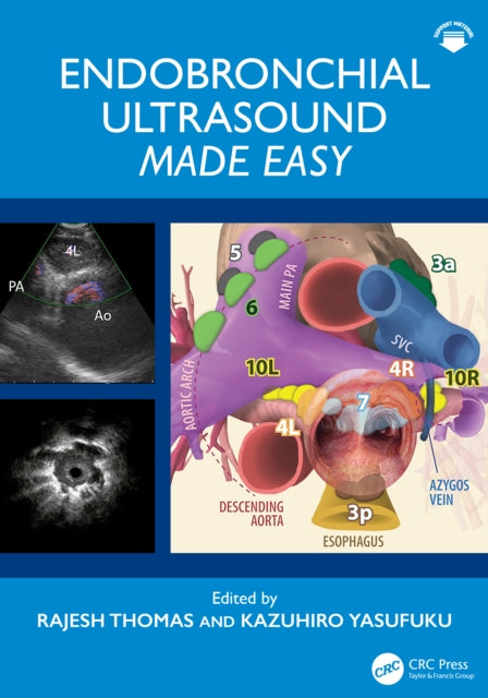 Book cover of: Endobronchial Ultrasound Made Easy