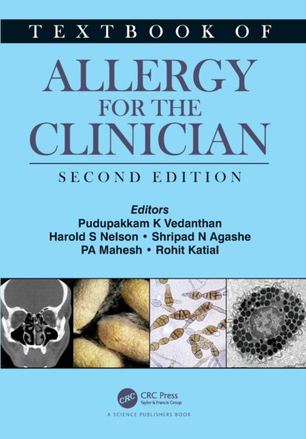 Book cover of: Textbook of Allergy for the Clinician