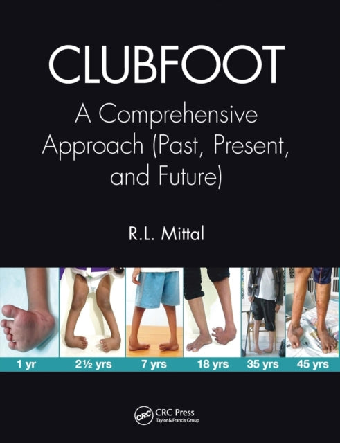 Book cover of: Clubfoot. By: R. L. Mittal