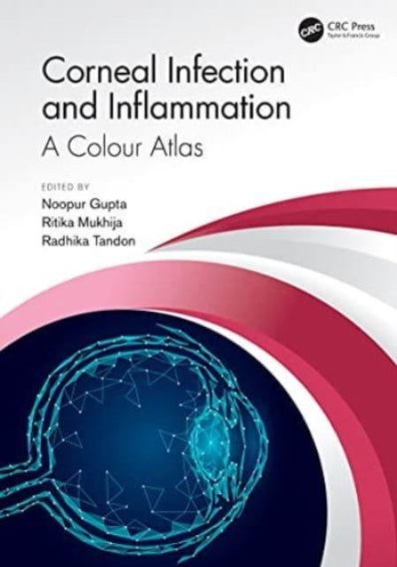 Book cover of: Corneal Infection and Inflammation. By: Noopur Gupta