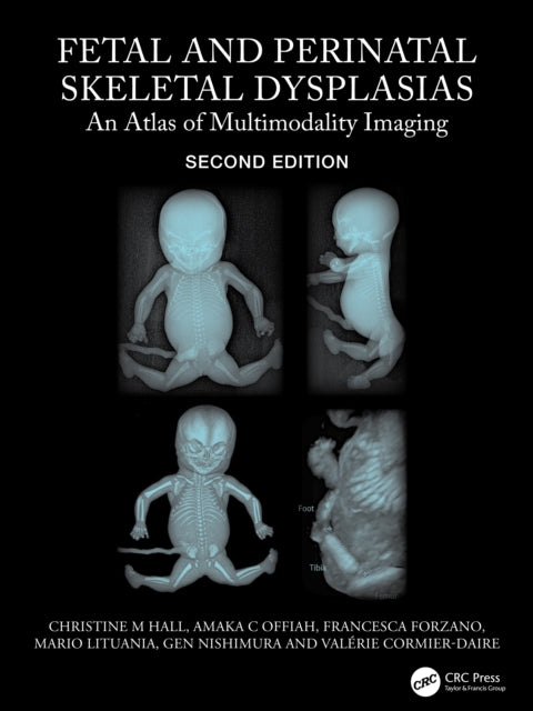 Book cover of: Fetal and Perinatal Skeletal Dysplasias. By: Christine M. Hall
