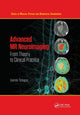 Book cover of: Advanced MR Neuroimaging. By: Ioannis Tsougos