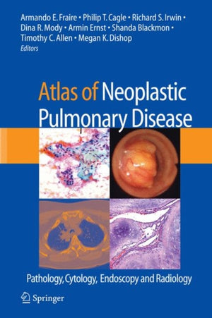 Atlas of Neoplastic Pulmonary Disease