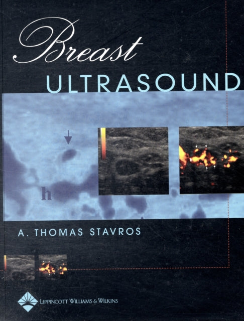 Book cover of: Breast Ultrasound. By: A. Thomas Stavros