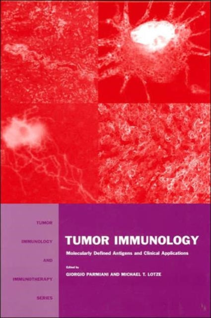 Book cover of: Tumor Immunology