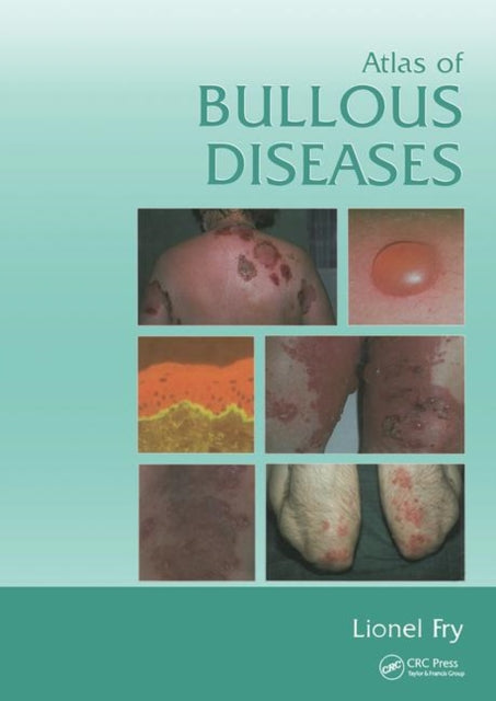 Book cover of: Atlas of Bullous Diseases. By: Lionel Fry