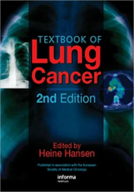 Book cover of: Textbook of Lung Cancer. By: Heine Hansen