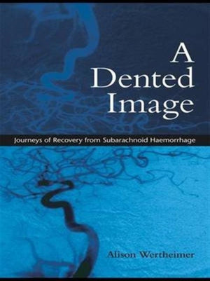 Dented Image