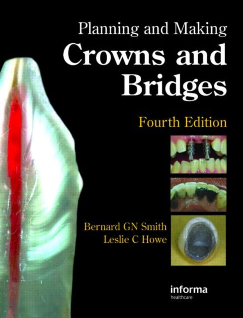 Book cover of: Planning and Making Crowns and Bridges. By: Bernard G. N. Smith