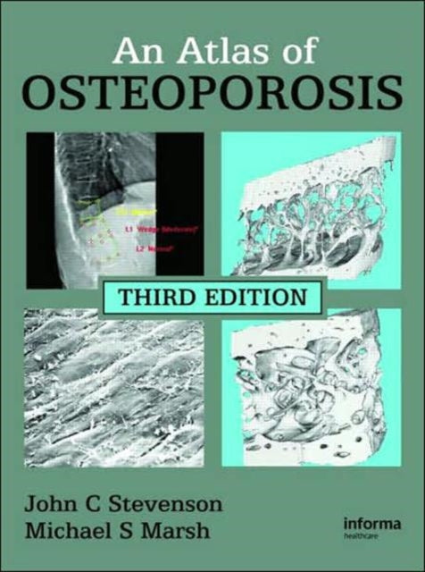 Book cover of: Atlas of Osteoporosis. By: John C. Stevenson