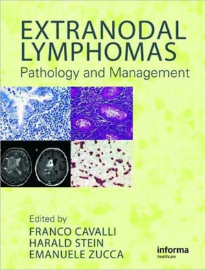 Extranodal Lymphomas