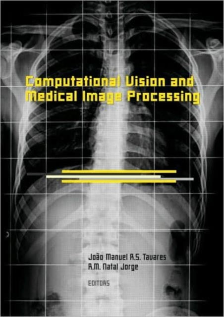 Book cover of: Computational Vision and Medical Image Processing. By: Tavares