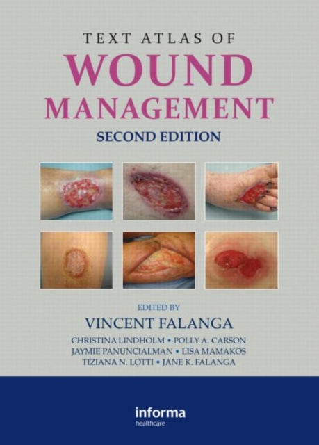 Book cover of: Text Atlas of Wound Management. By: Vincent Falanga