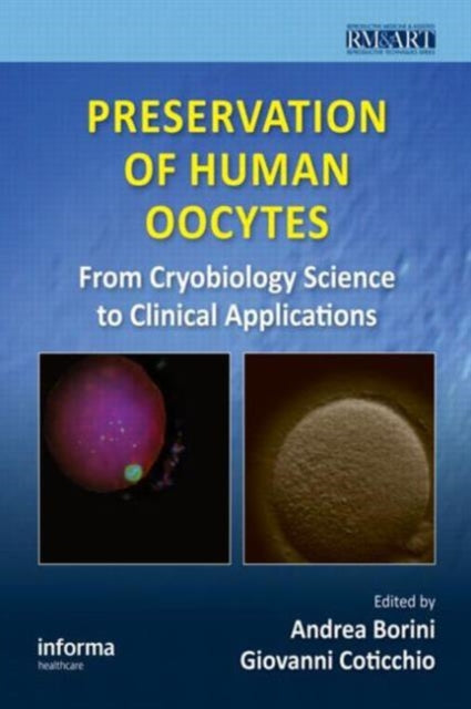 Book cover of: Preservation of Human Oocytes. By: Andrea Borini
