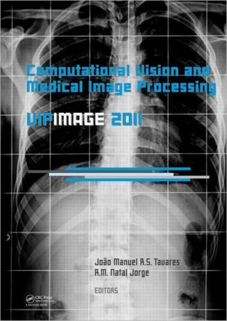 Book cover of: Computational Vision and Medical Image Processing: VipIMAGE 2011. By: João Manuel R. S. Tavares